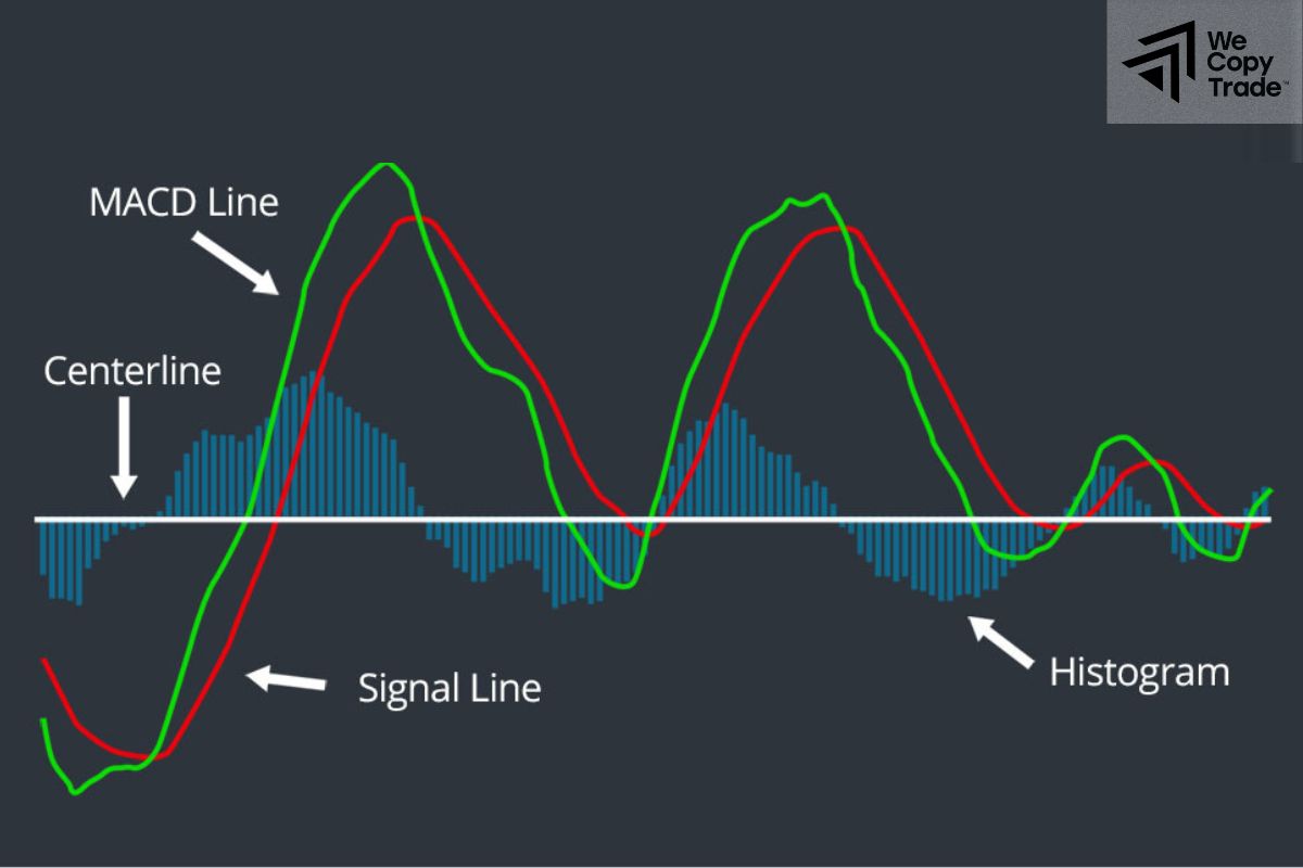 What are MACD Signals?